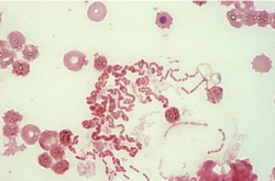 rhodobacter capsulatus